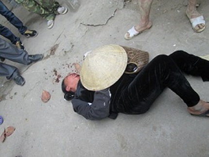 Con trai b&iacute; thư x&atilde; đ&aacute;nh d&atilde; man cụ gi&agrave; giữa đường 2