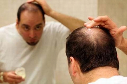 8 th&oacute;i quen tốt ngừa rụng t&oacute;c ở đ&agrave;n &ocirc;ng 1