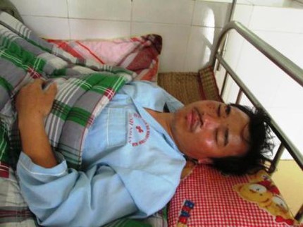 Lời kể của nạn nh&acirc;n sống s&oacute;t sau vụ nổ t&agrave;u kinh ho&agrave;ng 3