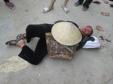 Con trai b&iacute; thư x&atilde; đ&aacute;nh d&atilde; man cụ gi&agrave; giữa đường 1