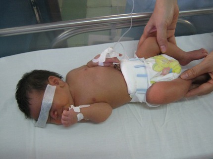 Sức sống m&atilde;nh liệt của đứa con bị mẹ bịt miệng 1