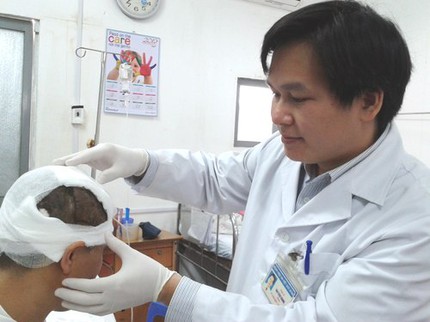 Nối th&agrave;nh c&ocirc;ng mảnh da đầu cho người bị m&aacute;y cuốn 1