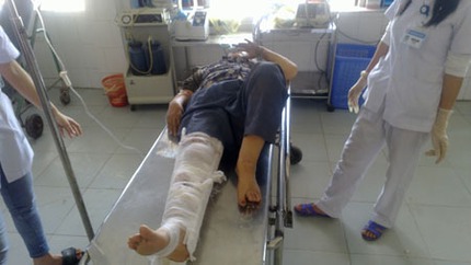 Lật xe chở kh&aacute;ch Việt kiều 11 người bị thương 4