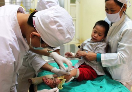 Mất 5 ng&oacute;n ch&acirc;n v&igrave; ng&acirc;m v&agrave;o nước ấm 1