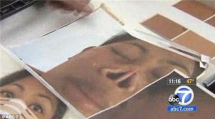 Dung nhan mới của người phụ nữ bị chồng xẻo mất mũi 2
