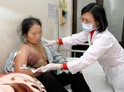 Kinh hoàng khối u khổng lồ thâm đen bị "nổ" 2 Kinh hoàng khối u khổng lồ thâm đen bị "nổ" 2