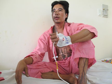 Bi kịch hai vợ chồng bị tạt axit giữa đường 2