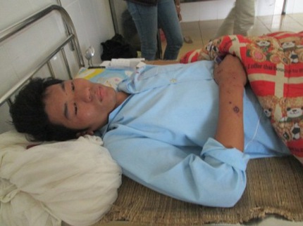 Lời kể của nạn nh&acirc;n sống s&oacute;t sau vụ nổ t&agrave;u kinh ho&agrave;ng 2