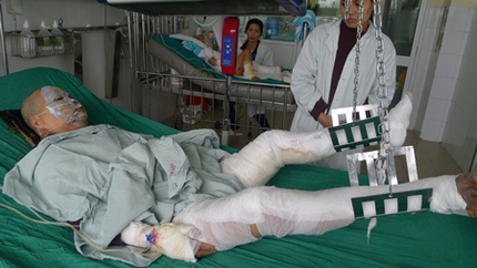 Nổ b&igrave;nh ga, 1 người chết, 6 người bỏng nặng 3